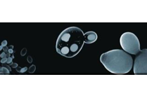 酵母互補實驗的快速檢測方法